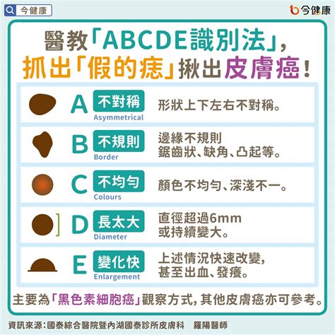 痣變大變凸|是痣？皮膚癌？還是什麼？常見Q&A解惑！醫教揪出「。